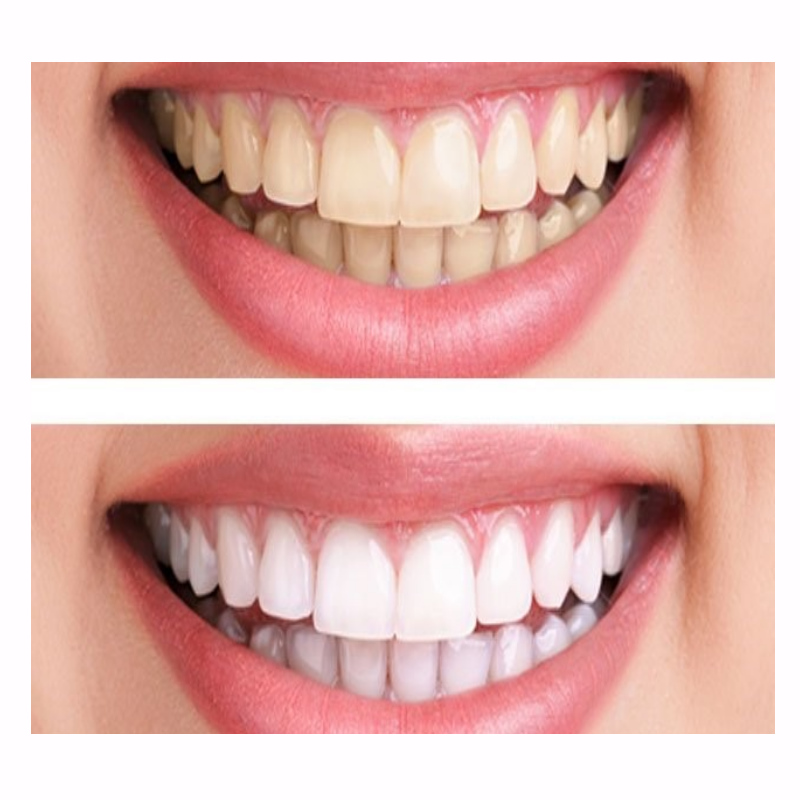 οδοντιατρος ντεπω θεσσαλονικη