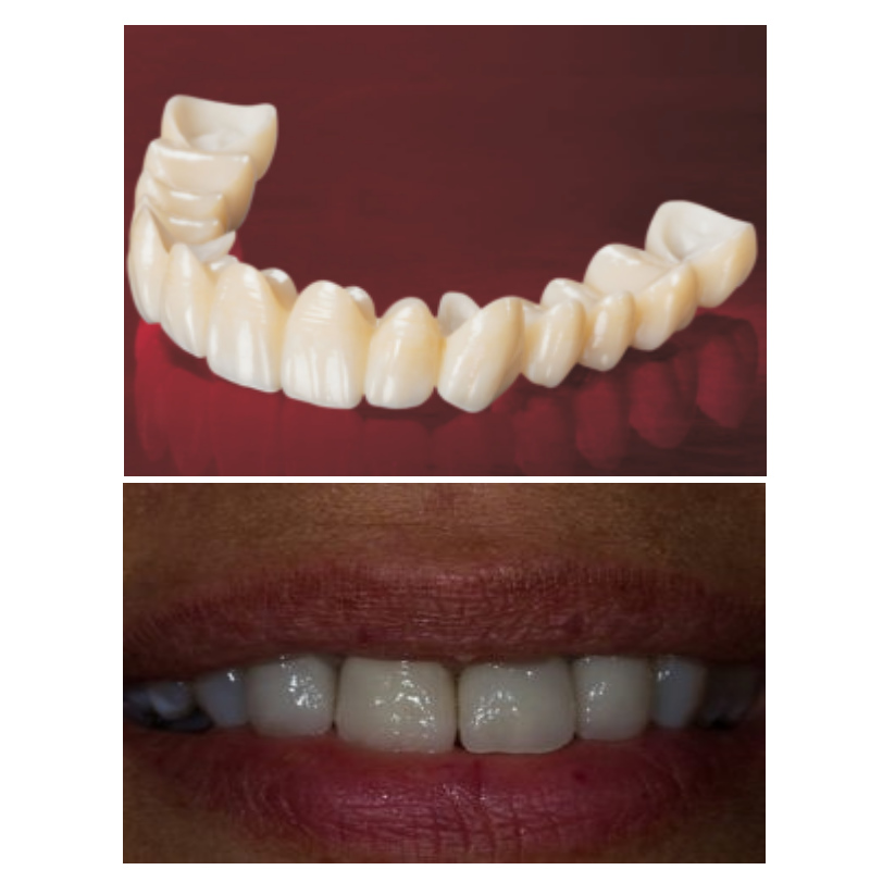 οδοντιατρος αναληψη θεσσαλονικη