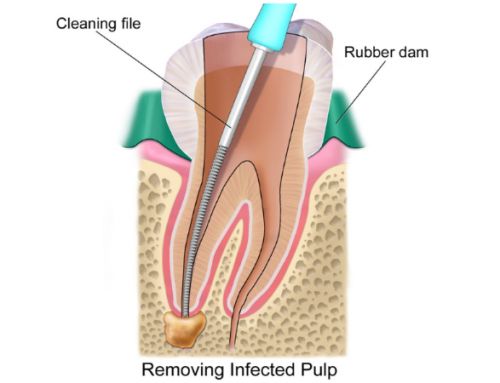 ΕΝΔΟΔΟΝΤΙΑ