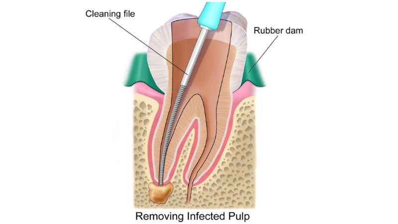 οδοντιατρος βασιλισσης ολγας