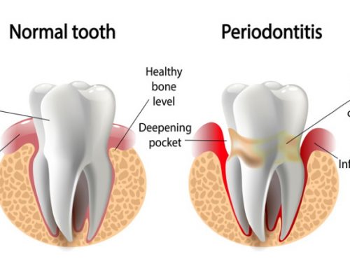 ΠΕΡΙΟΔΟΝΤΙΟ