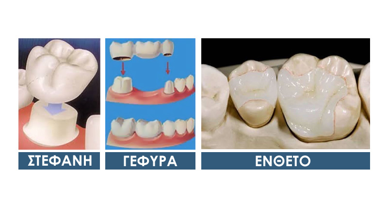 οδοντιατρος θεσσαλονικη